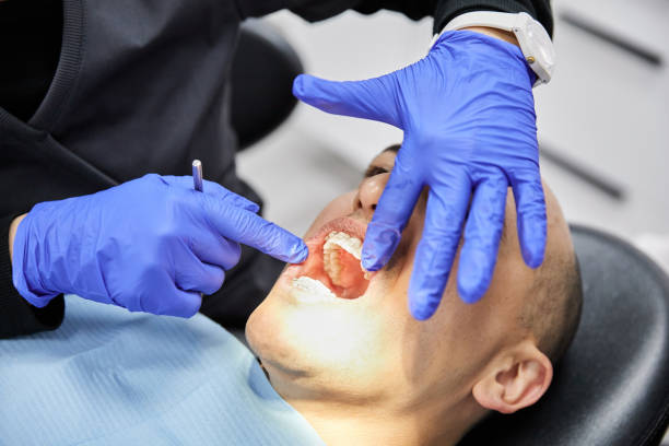 Best Chipped Tooth Repair Near Me  in Westminster, CO