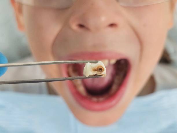 Emergency Gum Pain Relief in CO